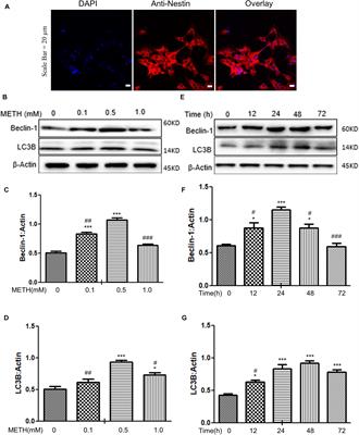 Autophagy Induction by HIV-Tat and Methamphetamine in Primary Midbrain Neuronal Cells of Tree Shrews via the mTOR Signaling and ATG5/ATG7 Pathway